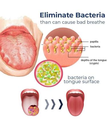 YANGYANGDA Tongue Removal Kit - Tongue Scraper & Cleaning Gel with Brush for Fresh Breath (2 Pack) | Effective Oral Hygiene Solution - Buy Online on GoSupps.com