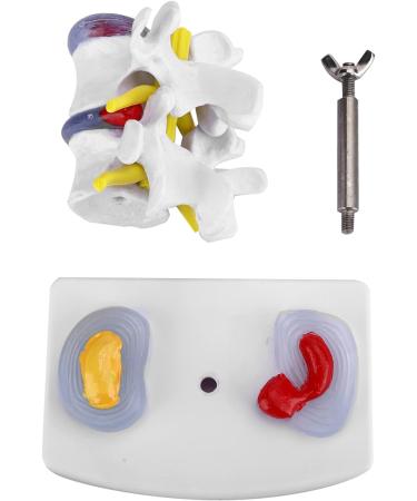 Anatomical Lumbar Intervertebral Disc Model - Spine Demonstration for Training & Education | International Shipping Available - Buy Online on GoSupps.com