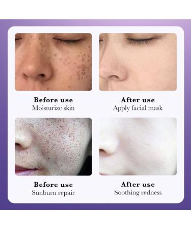 Cremas Para Las Manchas de La Cara Oscuras Para Eliminar Manchas en la Cara Crema Para Quitar Manchas de la Cara Crema Blanqueadora Para Pecas - Buy Online on GoSupps.com
