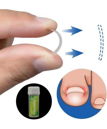 Toenail Tool 6 in 1 Ingrown Toe Nail Fixer Pedicure Toenail Recover Nail Foot Care Kit Ingrown Toenail Corrector for Men Women(24pcs) - Buy Online on GoSupps.com