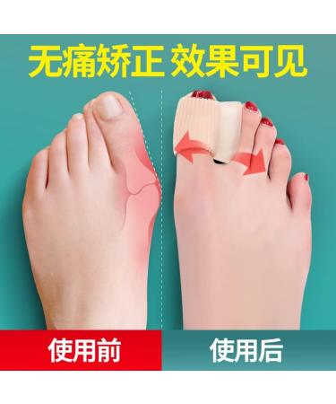 Thumb Valgus Corrector - Gel Support Brace for Men and Women - Buy Online on GoSupps.com