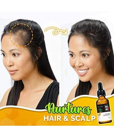  Sinye Hair Growth Serum Essential Oil Fast Hair Growth Treatment Herbal Essential Oil for Hair Loss Rapid Growth 30ml (B) - Buy Online on GoSupps.com