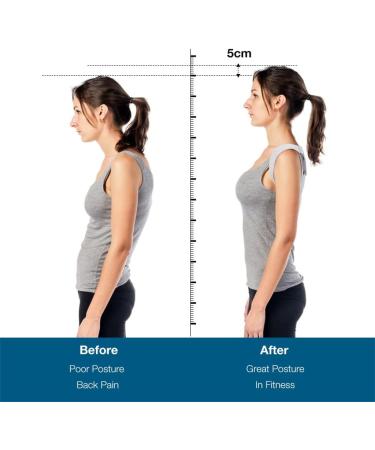 ZUIAI Adjustable Smart Intelligent Posture Corrector Vibration Back Brace Trainer Care(M) Medium As Shown - Buy Online on GoSupps.com