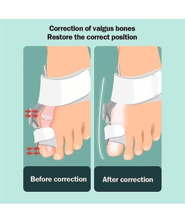 ZIROXI Bunion Corrector with Angle Adjustment Knob for Hallux Valgus Relief - Buy Online on GoSupps.com