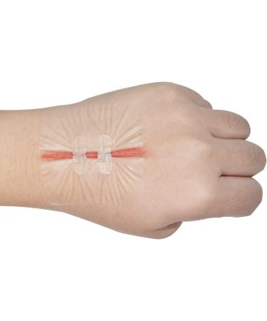 Greetmed Zip Stitch Sutures Butterfly Bandaids - 4 Pcs Laceration Closure Kit for Wounds - Quick Clot Zipstitch Bandages for Emergency Wound Care - Buy Online on GoSupps.com