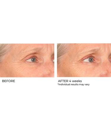NassifMD Pro Peptide Collagen Serum | Anti-Aging Treatment for Fine Lines Wrinkles & Textured Skin - Firm & Smooth Your Skin - Buy Online on GoSupps.com