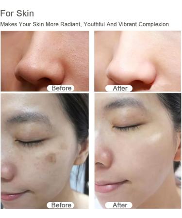 Rollnewskin Derma Roller for Beard Hair Skin Face 2Pack (0.5mm+1.0mm) 540 Titanium microneedle - Self Care Gifts for Men and Women Facial Skin Care Tools (0.5+1.0)mm - Buy Online on GoSupps.com