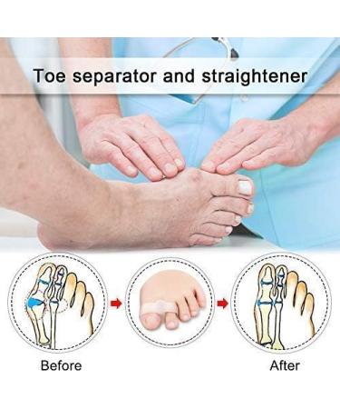 CAZARU FXJ Toe Straightener & Separator Socks - Valgus Hammer Toe Pain Relief for Medium Correction - Buy Online on GoSupps.com