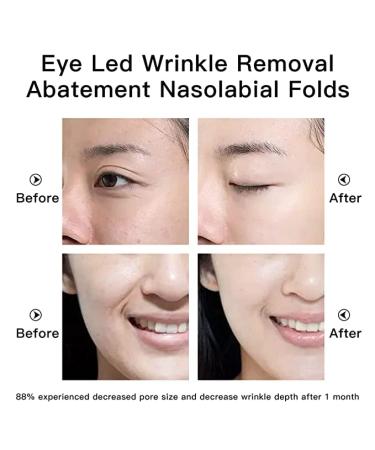 Aimanfun Eye Wrinkle Reduction Instrument | Wireless Remote Control Eye Massage Mask - Buy Online on GoSupps.com