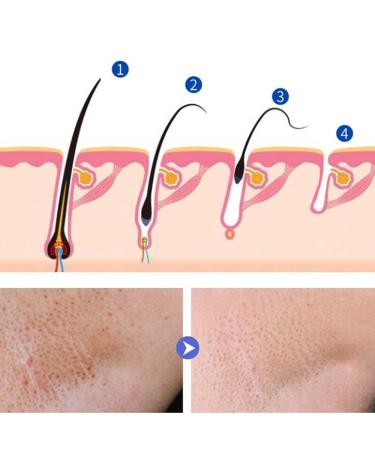 Hair Inhibitor Cream - Lavender Hair Growth Stopper for Face Bikini Arms & Legs - 50g | Best Post-Depilatory Solution - Buy Online on GoSupps.com