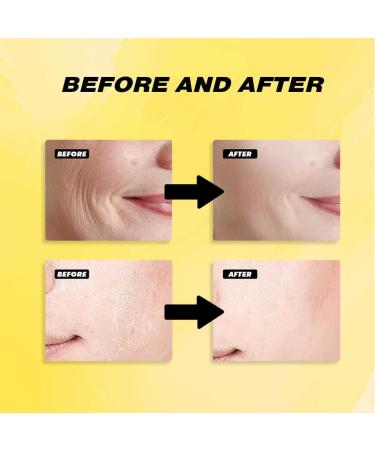 2PCS Retinol Facial Serum Capsules Hydrating & Brightening Boosts Skin Elasticity Reduces Fine Lines Daily Care - Buy Online on GoSupps.com