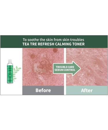 Secret Key Refresh Calming Toner with Tea Tree - Soothing Skin Solution 8.38 fl oz | International Shipping - Buy Online on GoSupps.com