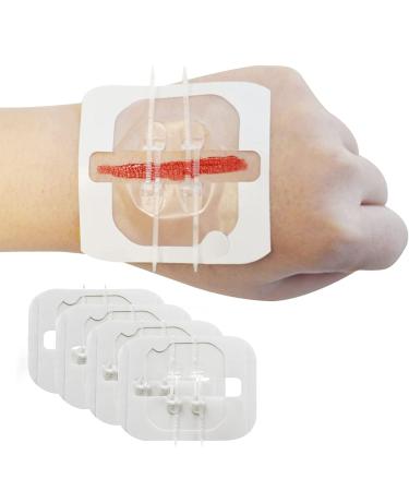 Greetmed Zip Stitch Sutures Butterfly Bandaids - 4 Pcs Zip Stitches for Wounds Care Laceration Closure Kit Zipstitch Bandages Quick Clot  Emergency Zipstitch Wound Closure Device - Buy Online on GoSupps.com