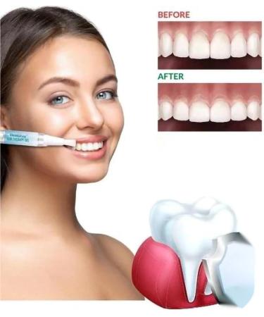 Clevermart Teeth Whitening Solutions | Fast & Effective Teeth Whitening Pen & Essence | Reduce Tooth Stains & Yellowing - Buy Online on GoSupps.com