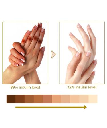 GFOUK Acanthosis Nigricans Dark Spot Peeling Oil - 1pcs - Buy Online on GoSupps.com