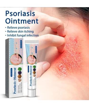 Eczema & Psoriasis Cream - Natural Relief for Dry, Itchy Skin | Scalp Rash Redness Acne - Buy Online on GoSupps.com