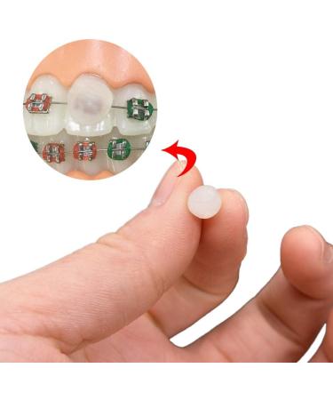 5 Pcs Dental Orthodontic Wax with Grape Scent for Brace Wearers - Gum Protection and Pain Relief - Buy Online on GoSupps.com