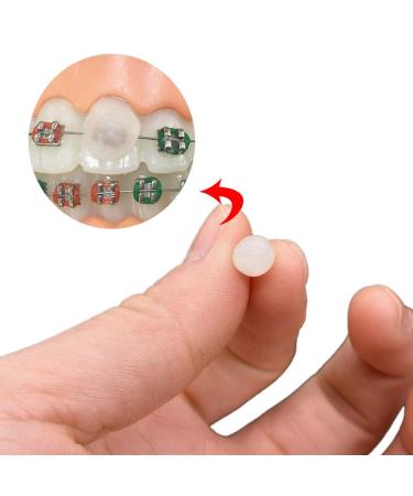 MBCARE Orthodontic Wax for Braces Wearer - Dental Care for Pain Relief - Buy Online on GoSupps.com