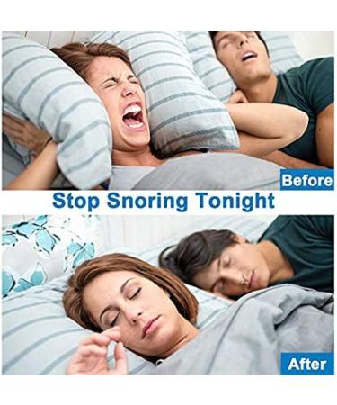 Comezy Anti Snoring Devices - 12 Nose Vents for Home and Travel - Snore Solution Nasal Dilators for Better Sleep - Buy Online on GoSupps.com