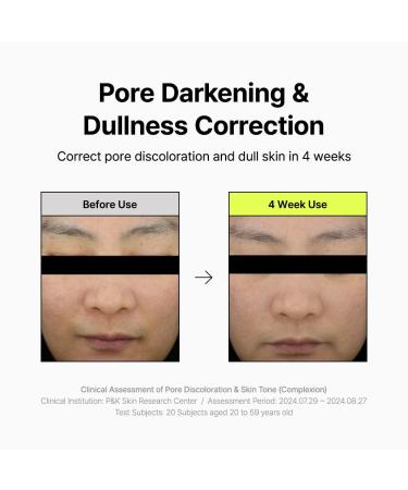 By Wishtrend Pore Smoothing Bakuchiol Serum 1.01 Fl Oz Pore Minimizer Enhanced with Bakuchiol & Niacinamide Peptide Increase production of Collagen Fiber for saggy & enlarged pores - Buy Online on GoSupps.com