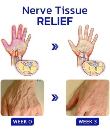 Gfouk Numbfix Lot de 2 vaporisateurs pour mains et pieds pour l'inconfort caus par les articulations les mains et les pieds cr me hydratante naturelle pour soulager les pieds les mains et les 2 Pi ces. - Buy Online on GoSupps.com