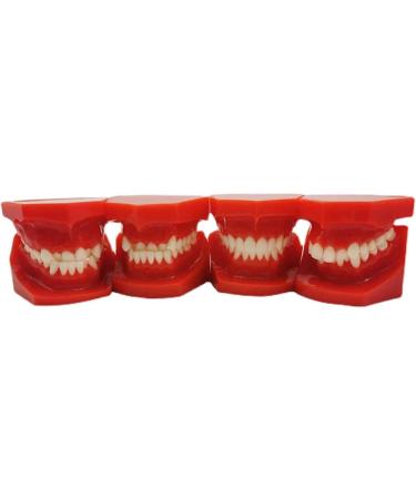 Teeth Educational Model - Orthodontic Classification & Lesson Model for Dental Training | International Shipping Available - Buy Online on GoSupps.com