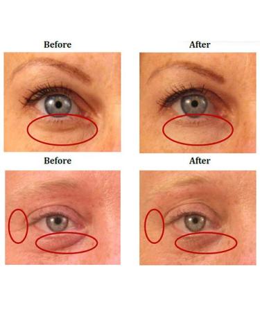 Eyelift Xpress Caffeine Roller - Instant Eye Depuffing & Brightening | Buy Worldwide - Buy Online on GoSupps.com