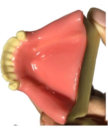 Buy Fhuili Dental Implant Practice Model - Mandibular Missing Teeth Simulation with Soft Gums for Oral Demonstration - Ideal for Dental Training - Buy Online on GoSupps.com