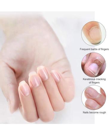 4-Piece Nail Care Set: Nail Hardener Oil Pen & Treatment for Stronger Healthier Nails - Buy Online on GoSupps.com
