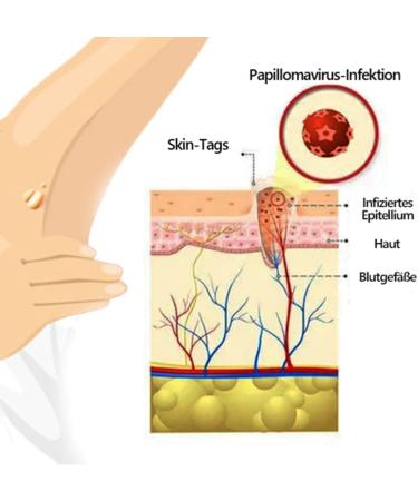 Bee Venom Ointment & Cream - 30ml Moisturizing Treatment for All Skin Types | Natural Anti-Aging Formula for Men & Women - Buy Online on GoSupps.com