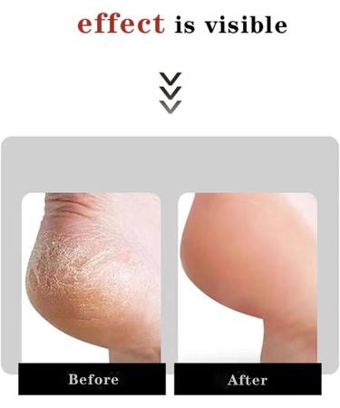 Foot Grinder Double Sided Foot File Foot Care for Removing Hard Dead Skin White - Buy Online on GoSupps.com