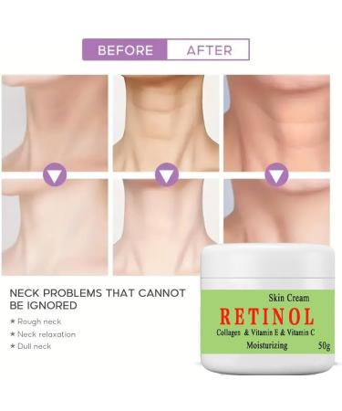 50ml*2PCS Crema para Las Manchas De La Cara Crema para La Cara Antiarrugas Face Moisturizing Cream para Piel Entrepierna Manchas Codos Piernas Zonas - Buy Online on GoSupps.com