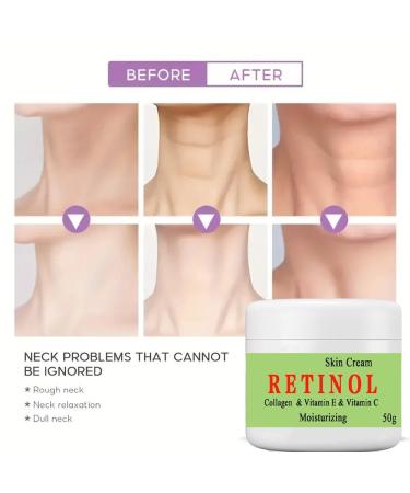 BEROZA Cremas Para Las Manchas de La Cara 50g Vitamina C&E para la cara mujer Face Moisturizer Cream Adecuado para varias reas como cara axilas cuello zona privade (2pcs) - Buy Online on GoSupps.com