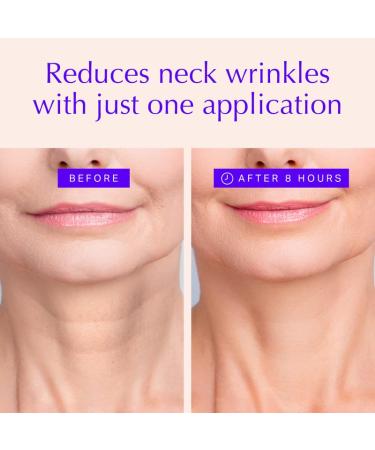 BLUMBODY Neck Wrinkle Pads - Anti-Aging Silicone Patches for Skin Firming & Tightening - Overnight Reusable Treatment for Neck Lift - 3 Pack - Buy Online on GoSupps.com