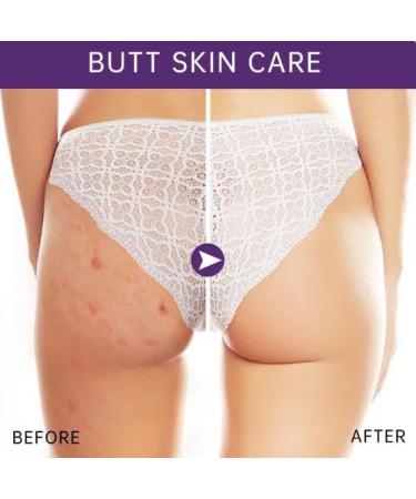 2 Pcs Crema Blanqueadora Para Partes Intimas 50 ml Crema de Blanqueamiento de Gl teos Axila Blanqueamiento de Gl teos y Muslos Crema Hidratante Para Reparar Caderas - Buy Online on GoSupps.com