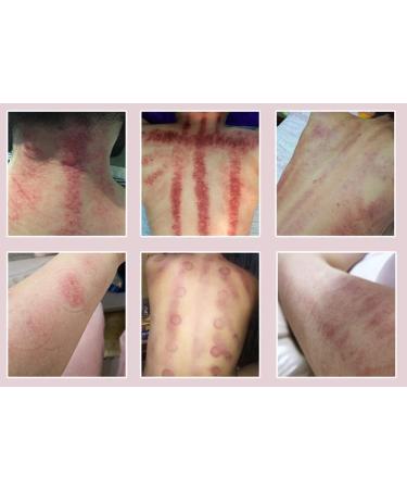 Buy 3 in 1 Electric Gua Sha Scrapers - Cupping for Face Back & Full Body - Titan Suction Massage Heads for Myofascial Release & Lymphatic Drainage - International Shipping Available - Buy Online on GoSupps.com