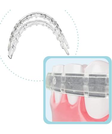 Tecnidentusa Clip-On Comfort Lip Shield - Braces Dental Wax Alternative - Buy Online on GoSupps.com