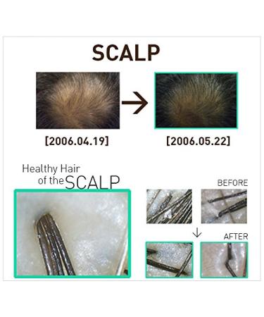 Dr Ross BIOGEM pH-Balanced Revitalizing Shampoo for Oily Hair - 355ml | Shop Internationally for Healthy Hair - Buy Online on GoSupps.com