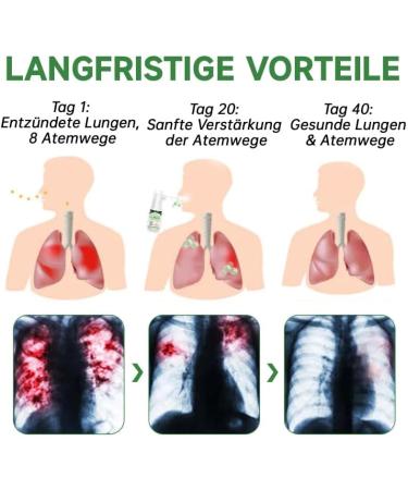 LOVILDS Herbal Lung Cleansing Spray - Repair & Detoxify (3PCS) | International Shipping Available - Buy Online on GoSupps.com