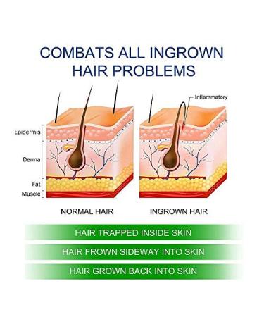 Princereigns Shaving Gel - 2 Fl Oz (Pack of 1) for Ingrown Hair & Razor Bumps Removal - Buy Online on GoSupps.com