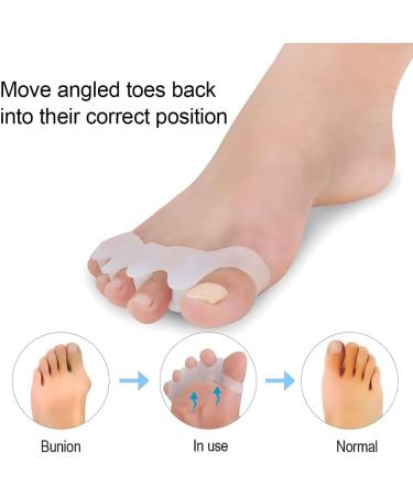 Soft Gel Toe Spacers for Bunion Correction | Toe Separators & Straighteners - Restore Toes Shape (White - Buy Online on GoSupps.com