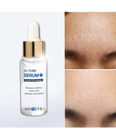 Buy AC Pure Serum | Best International Shipping | High-Quality Skincare - Buy Online on GoSupps.com