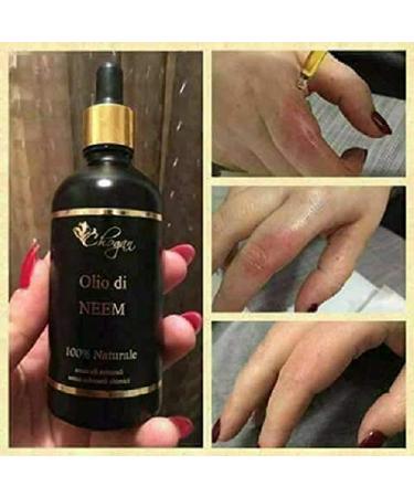 Chogan Neem Oil - 100% Pure Neem Oil 100ml | Organic Vegetable Oil for Skincare & Wellness | International Shipping - Buy Online on GoSupps.com