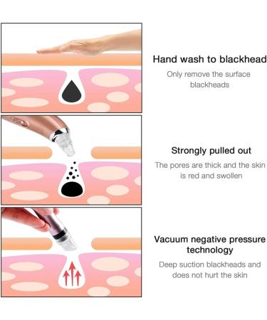 Portable Oxygen Spray Water Injection Hydro Beauty Tool for Deep Cleaning Exfoliating Lifting Firming - Buy Online on GoSupps.com