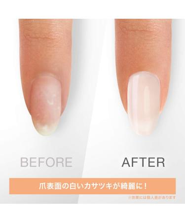 OPI Gel Break 3-Step Nail Treatment System 0.5 fl oz - Step 1: Base Coat Serum - Buy Online on GoSupps.com