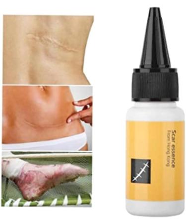 Delicate Skin Scar Treatment Serum - Acne Scar Removal & Repair Cream - 20ml - Buy Online on GoSupps.com