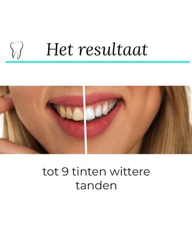 Glory of White Professional Teeth Whitening Strips 28 Strips Teeth Whitening Strips Whiter Teeth Without Peroxide Teeth Whitening Not tested on animals - Buy Online on GoSupps.com