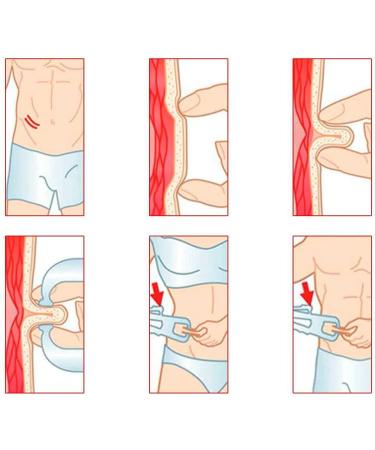 OcioDual Body Fat Caliper - Accurate Body Fat Measurement Tool White Model A | International Shipping Available - Buy Online on GoSupps.com