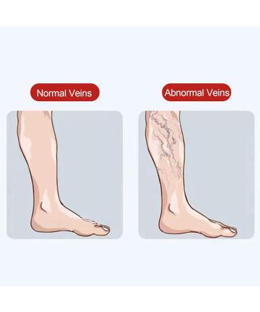 Besser Pavement for Legs | Vlies Varicose Vein Treatment | Legal Plaster Massage for Varicose & Spider Veins Relief - Buy Online on GoSupps.com