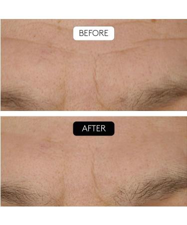 COCUNAT SL CLINICAL BEAUTY FILLER AntiWrinkle Treatment 1 Application Stimulates Collagen Combats Skin Sagging Simple Painless and Safe With Hyaluronic Acid and Peptides Argyle - Buy Online on GoSupps.com